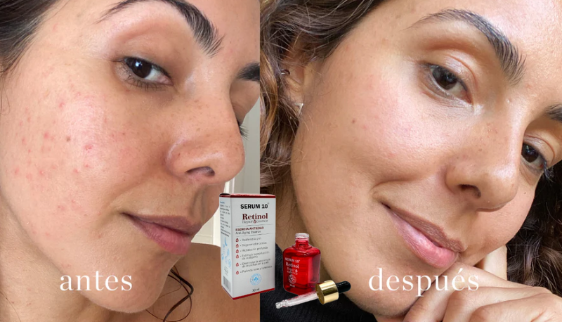 RETINOL 10® | REDUCE CICATRICES Y LINEAS FINAS